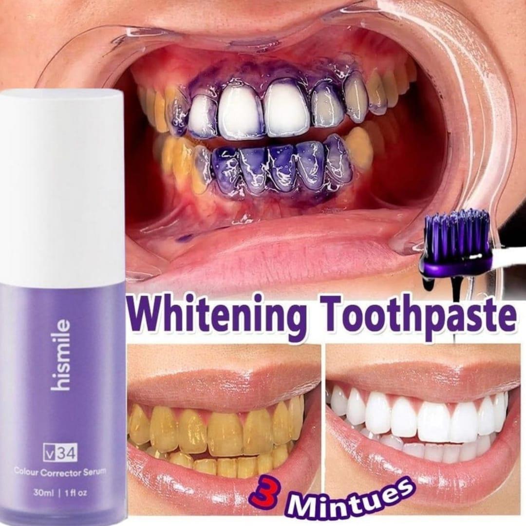 HiSmile Teeth Whitening Paste